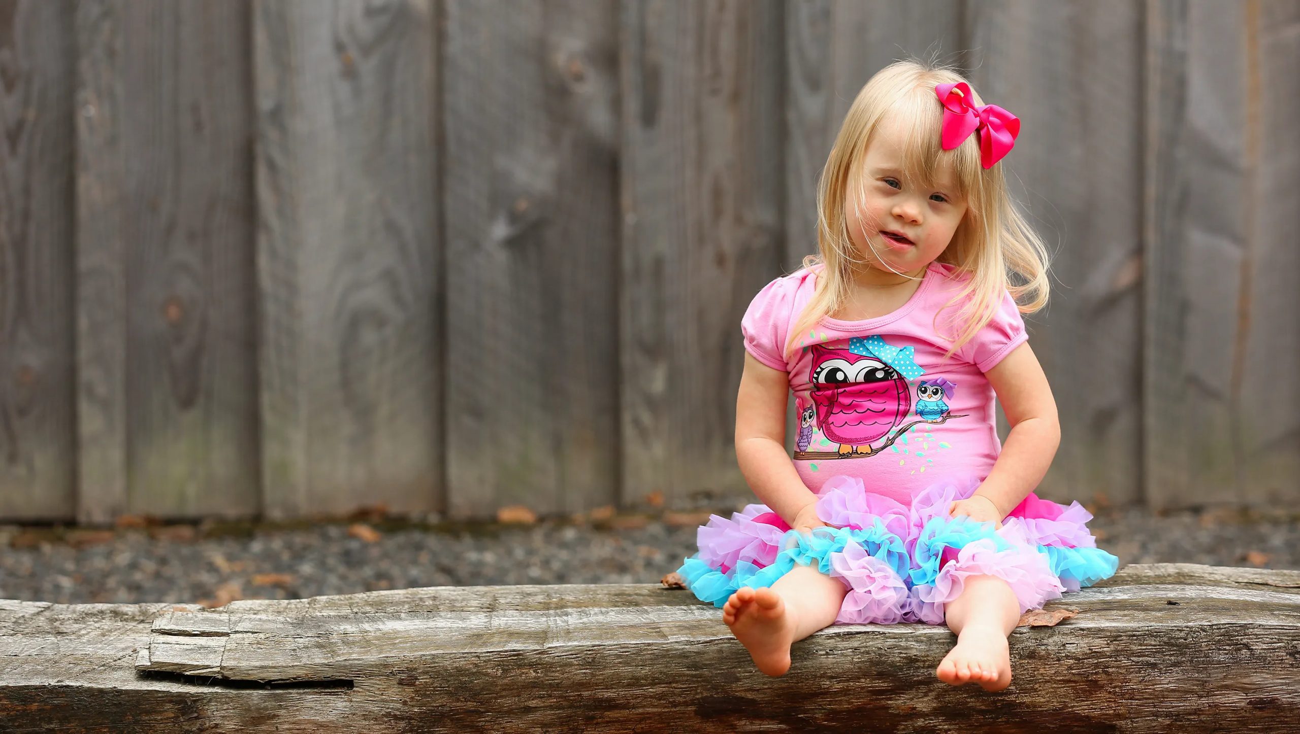 DOWN SENDROMLU ÇOCUKLAR YAŞITLARIYLA OKULA GİTMELİ